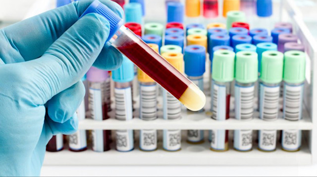 Alabamians can now request STD test kits through the mail